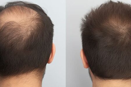 Come avere capelli più folti